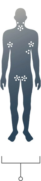 Demographics of the disease in human body.