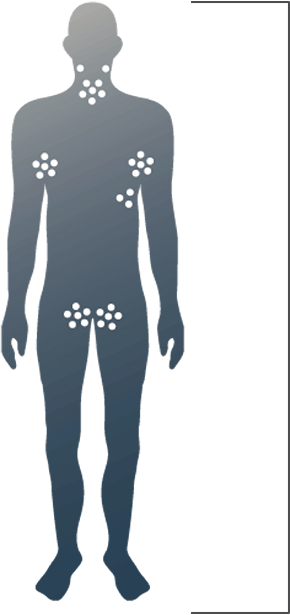 Demographics of the disease in human body.