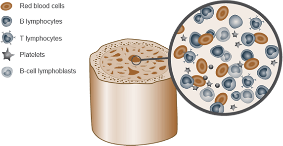 Lymphocytes in the bone marrow.