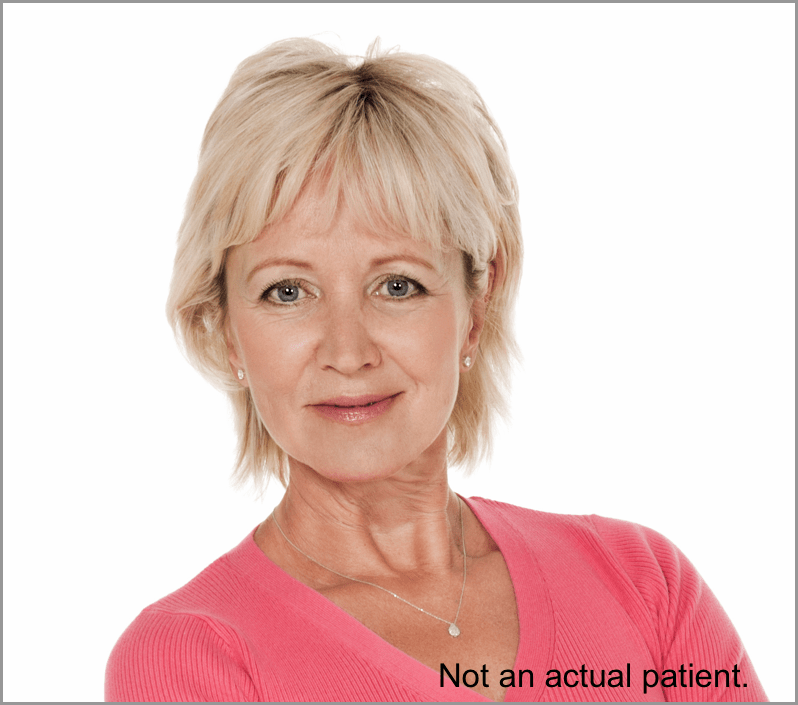 Headshot of a female representing
TECARTUS® patient.
