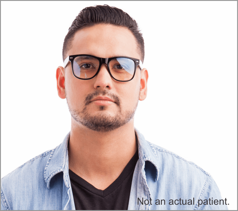 Headshot of a male representing
TECARTUS® patient.